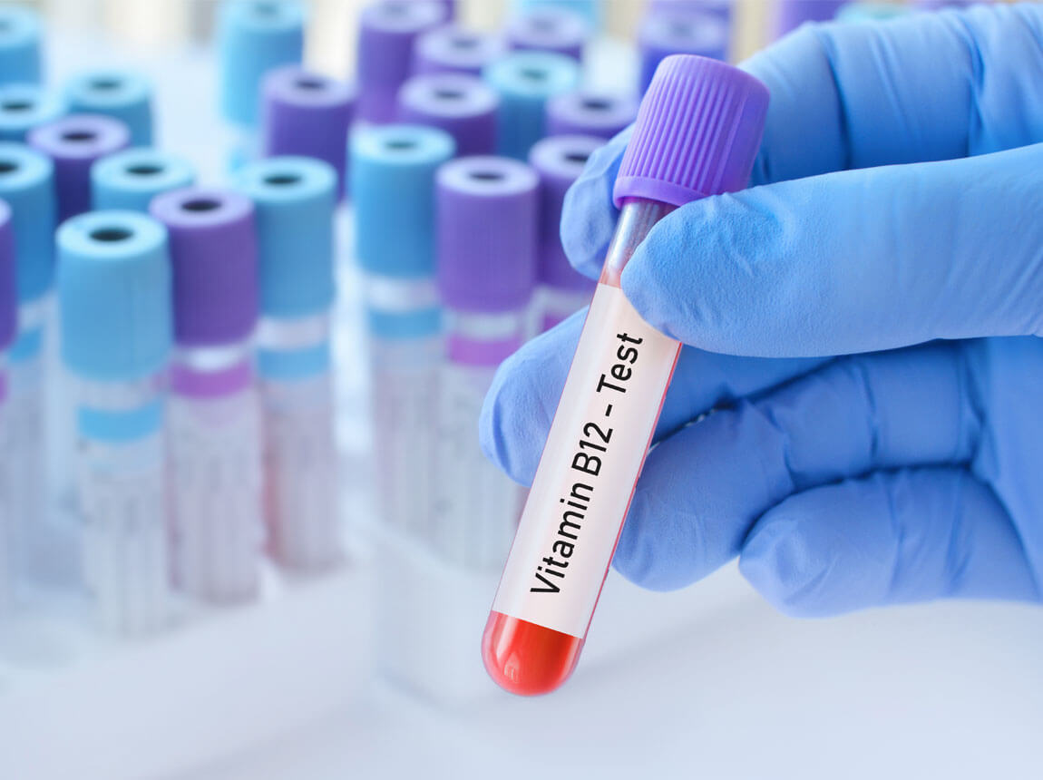 Vitamin B12 test 