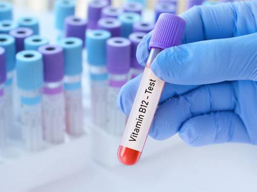 Vitamin B12 deficiency – causes, symptoms