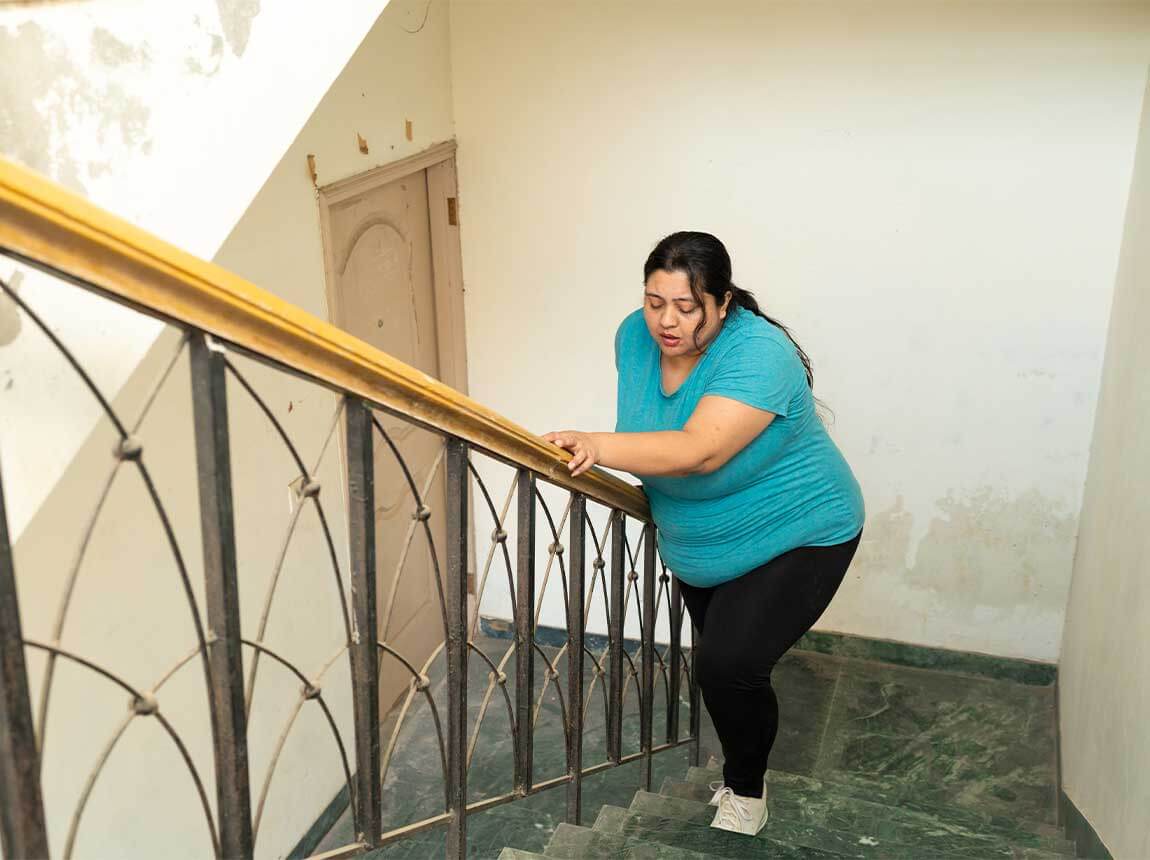 woman &ndash; obesity, shortness of breath when climbing stairs